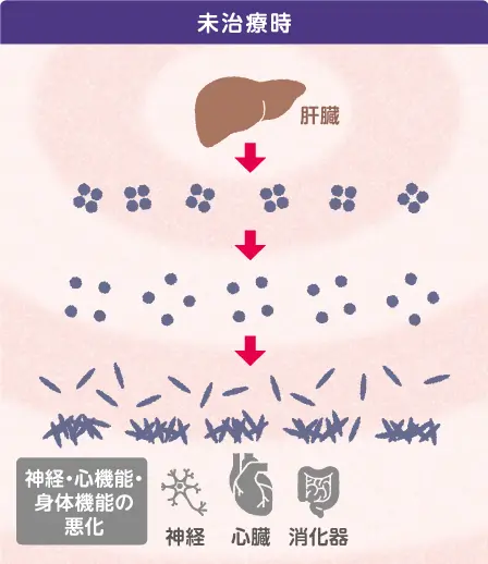 アムヴトラの効果 未治療時