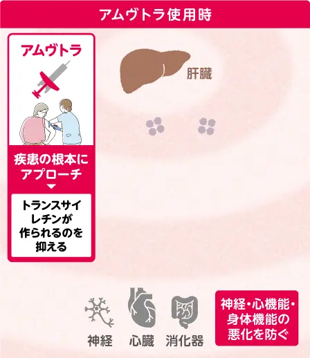 アムヴトラの効果 アムヴトラ使用時